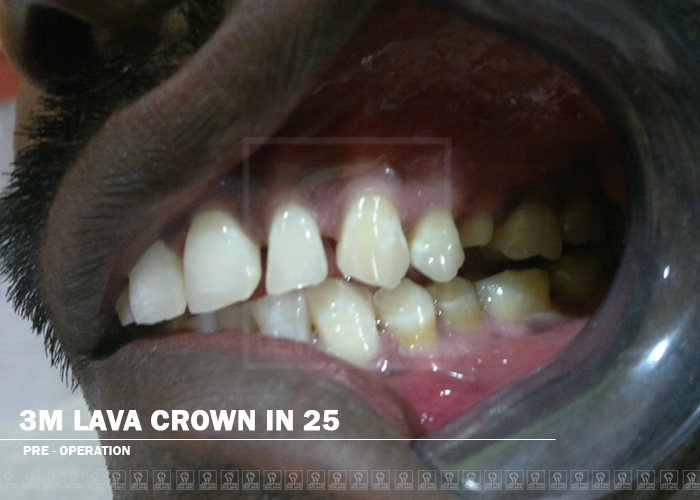 Case Studies, Jothi Dental & Cosmetology Centre, Chennai