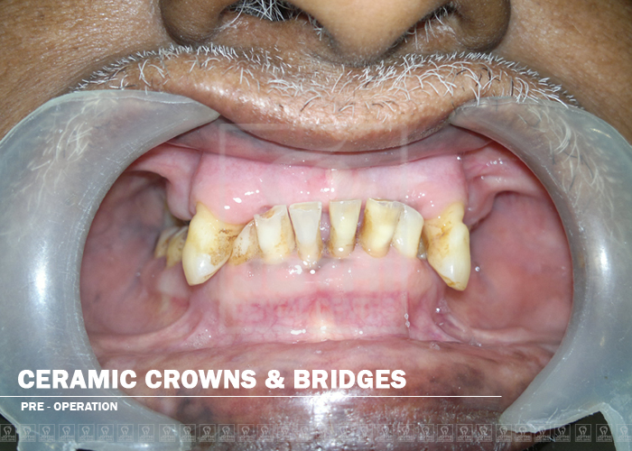 Case Studies, Jothi Dental & Cosmetology Centre, Chennai