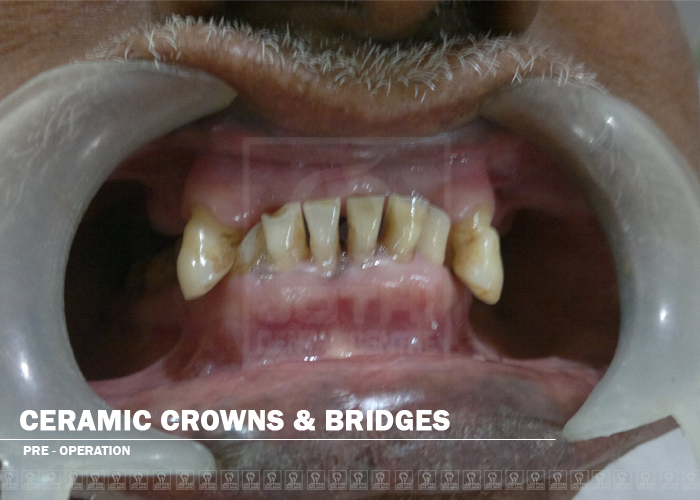 Case Studies, Jothi Dental & Cosmetology Centre, Chennai