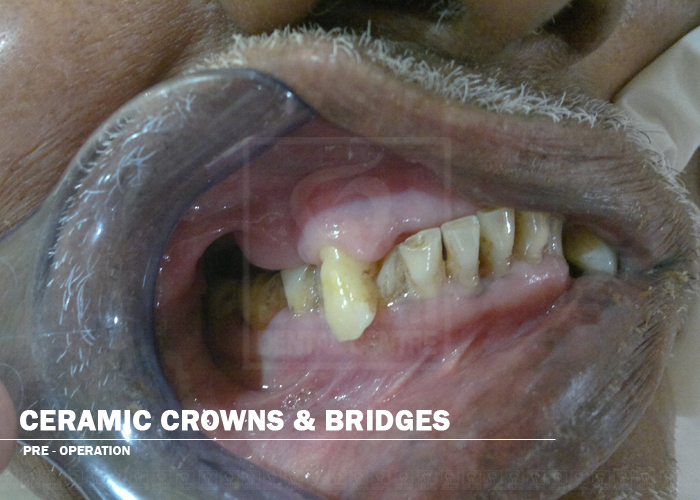 Case Studies, Jothi Dental & Cosmetology Centre, Chennai