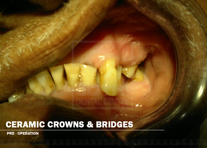 Case Studies, Jothi Dental & Cosmetology Centre, Chennai