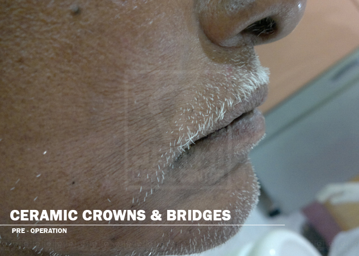 Case Studies, Jothi Dental & Cosmetology Centre, Chennai