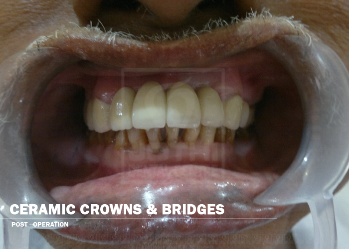 Case Studies, Jothi Dental & Cosmetology Centre, Chennai
