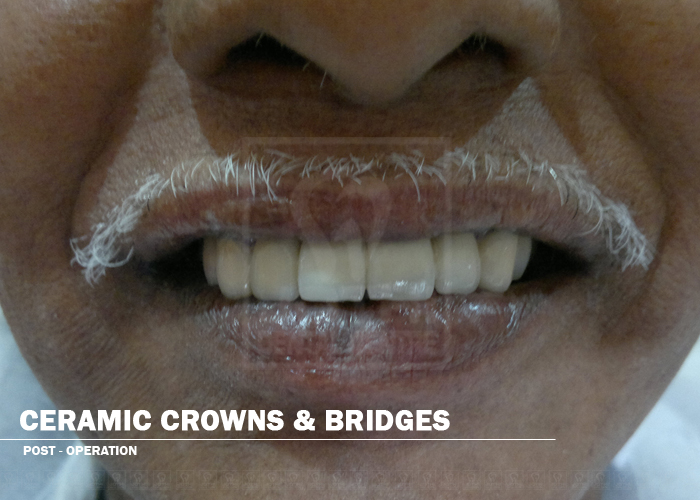 Case Studies, Jothi Dental & Cosmetology Centre, Chennai