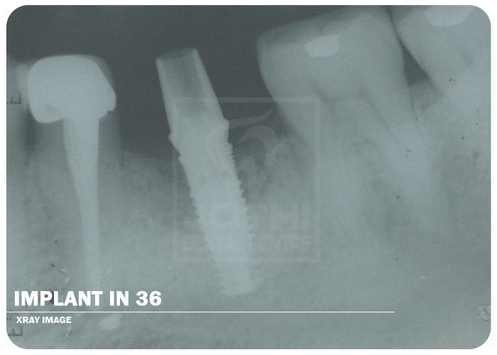 Case Studies, Jothi Dental & Cosmetology Centre, Chennai