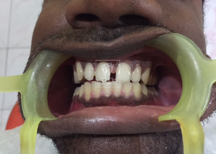 Case Studies, Jothi Dental & Cosmetology Centre, Chennai