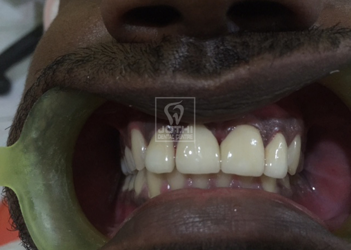 Case Studies, Jothi Dental & Cosmetology Centre, Chennai