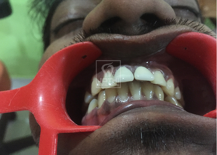 Case Studies, Jothi Dental & Cosmetology Centre, Chennai
