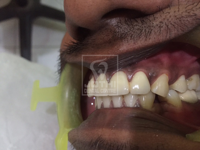 Case Studies, Jothi Dental & Cosmetology Centre, Chennai