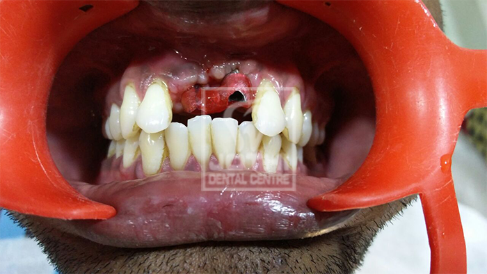 Case Studies, Jothi Dental & Cosmetology Centre, Chennai
