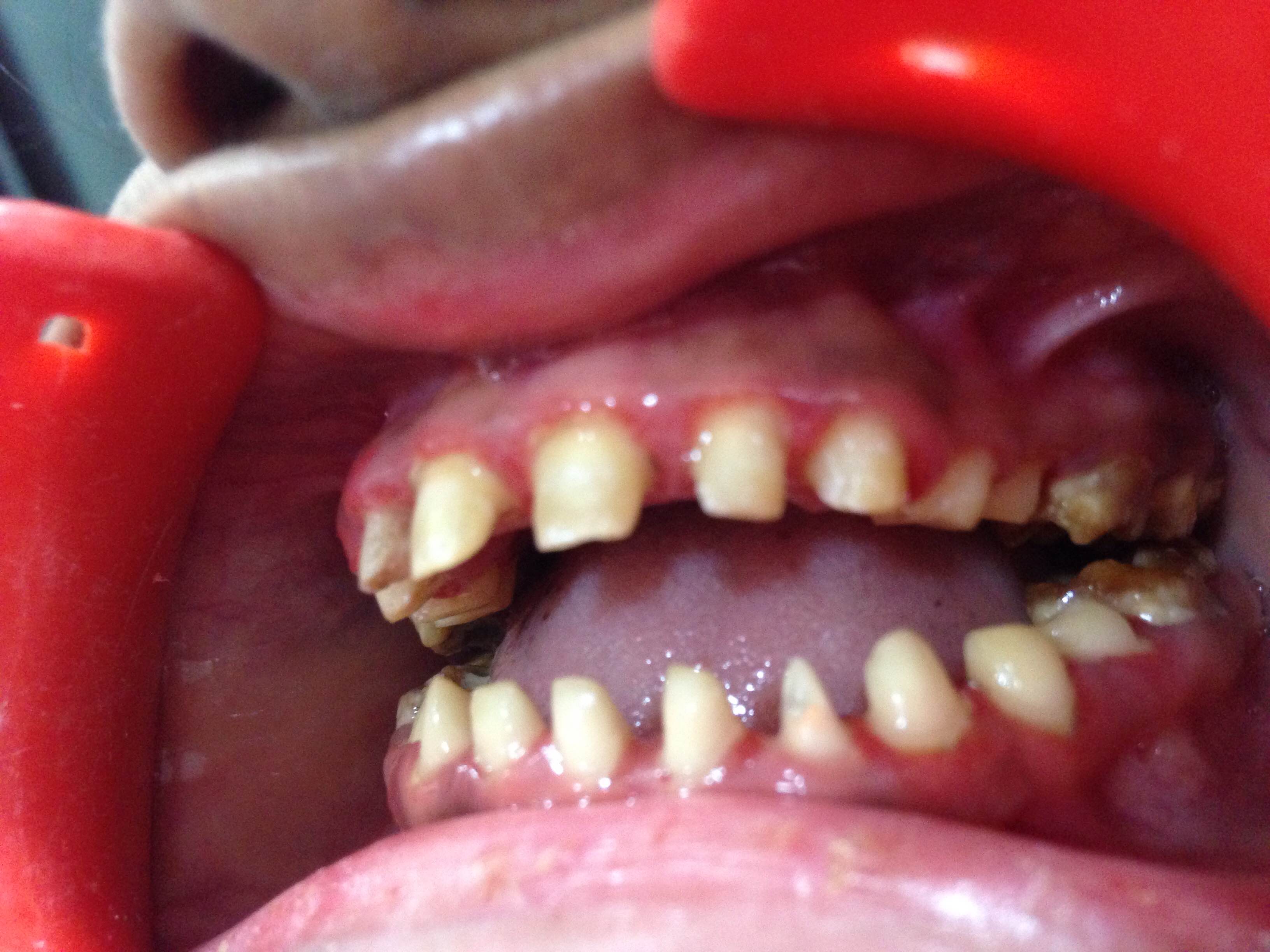 Case Studies, Jothi Dental & Cosmetology Centre, Chennai