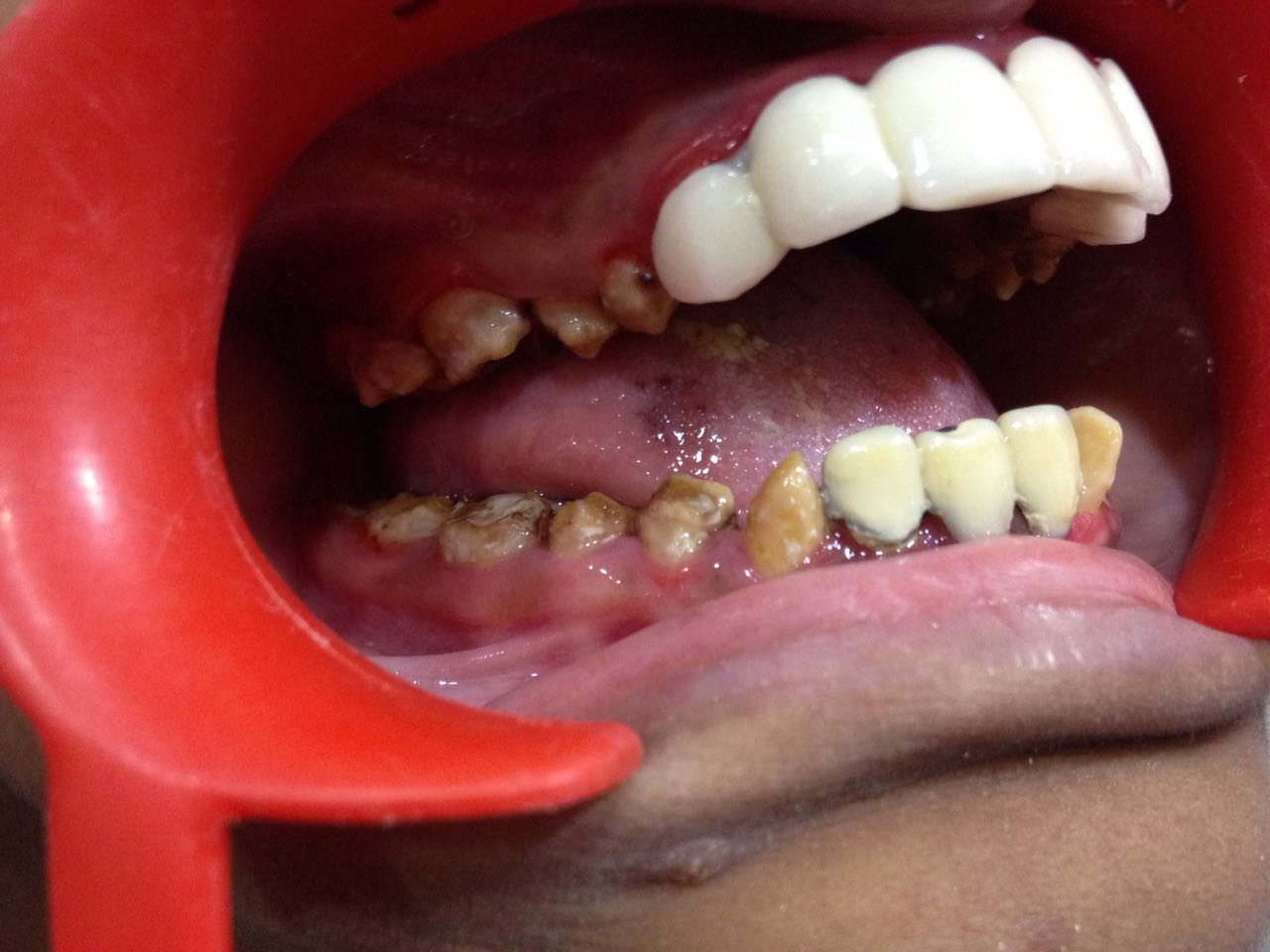 Case Studies, Jothi Dental & Cosmetology Centre, Chennai