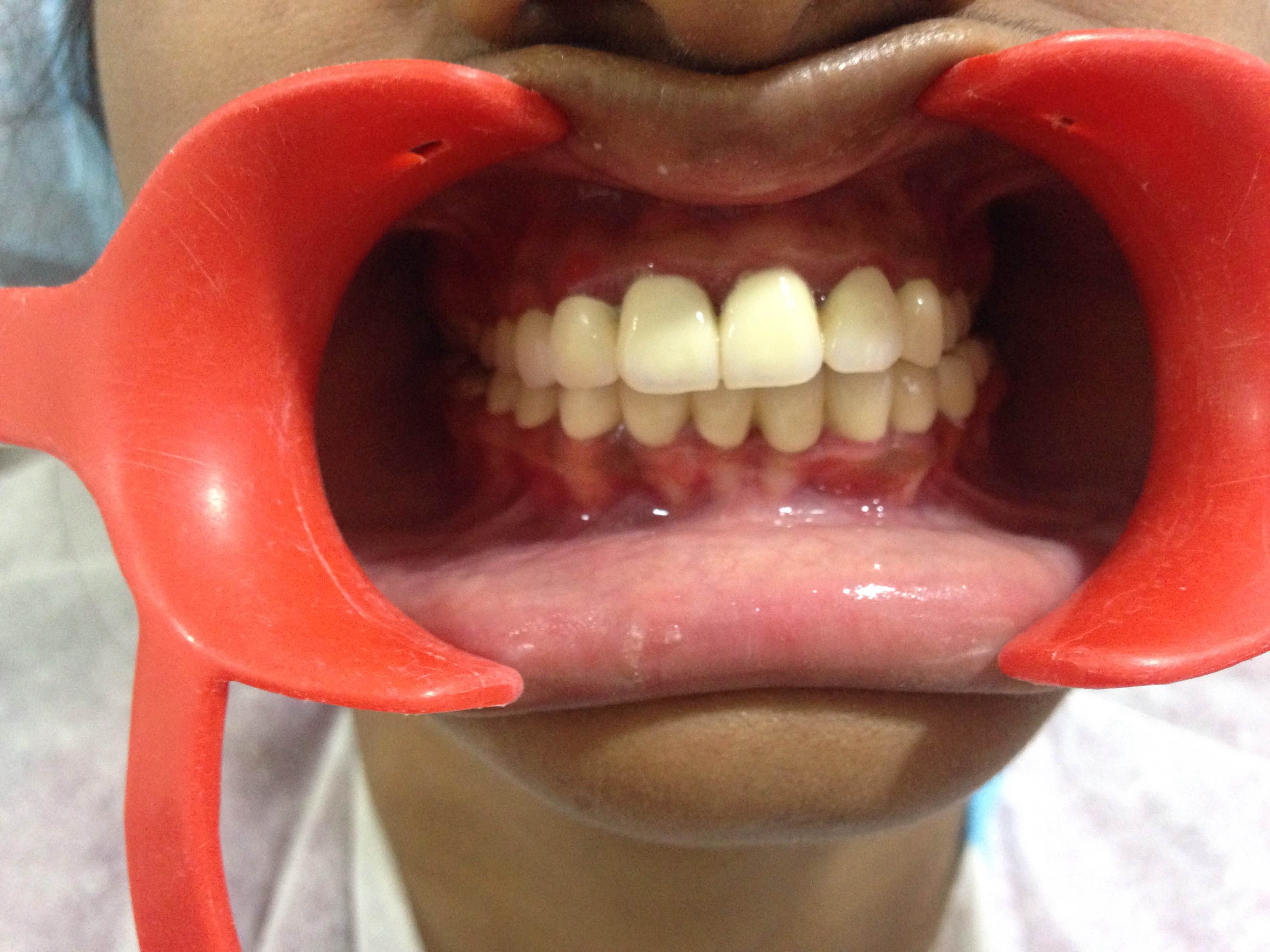 Case Studies, Jothi Dental & Cosmetology Centre, Chennai