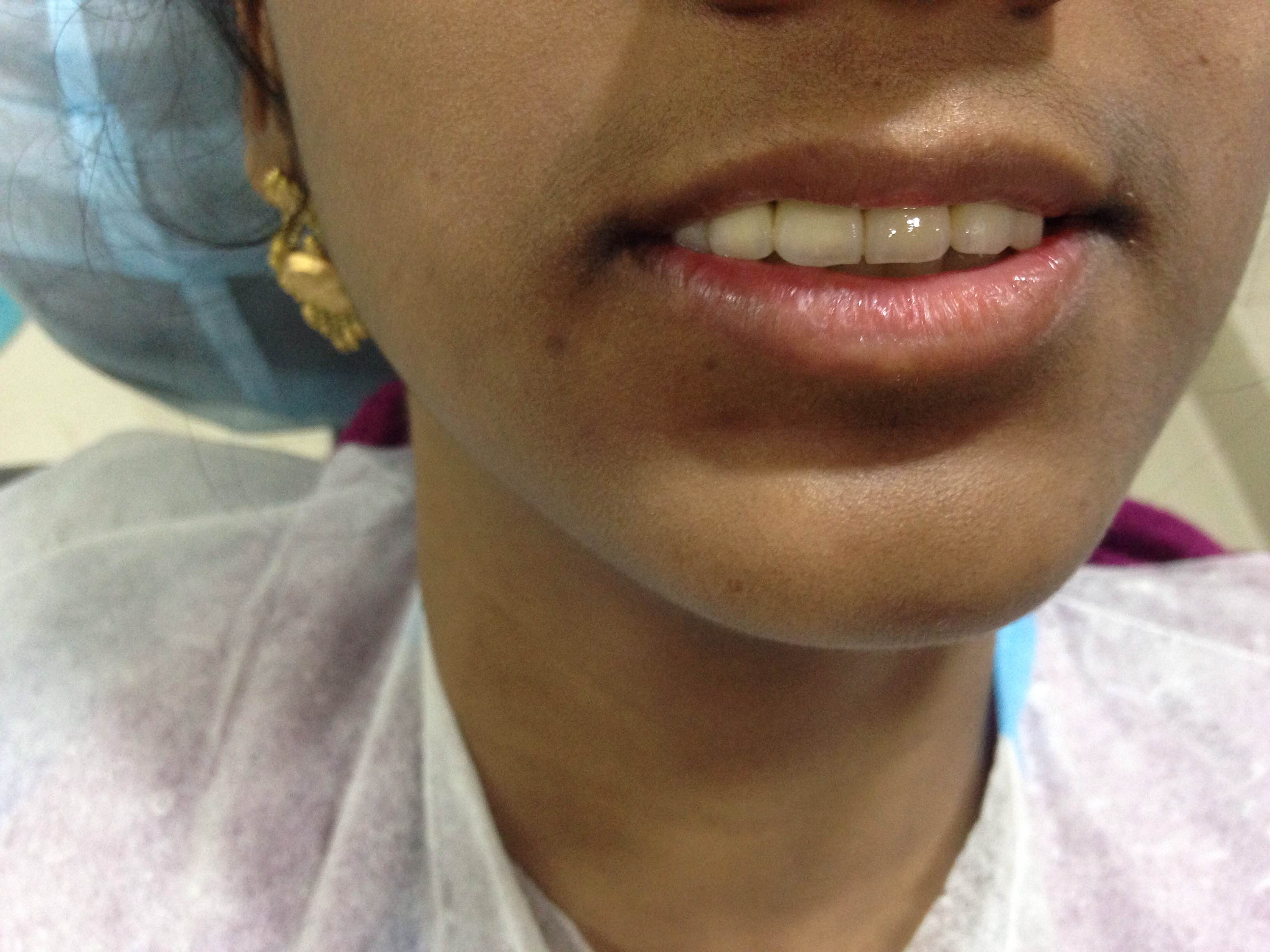 Case Studies, Jothi Dental & Cosmetology Centre, Chennai