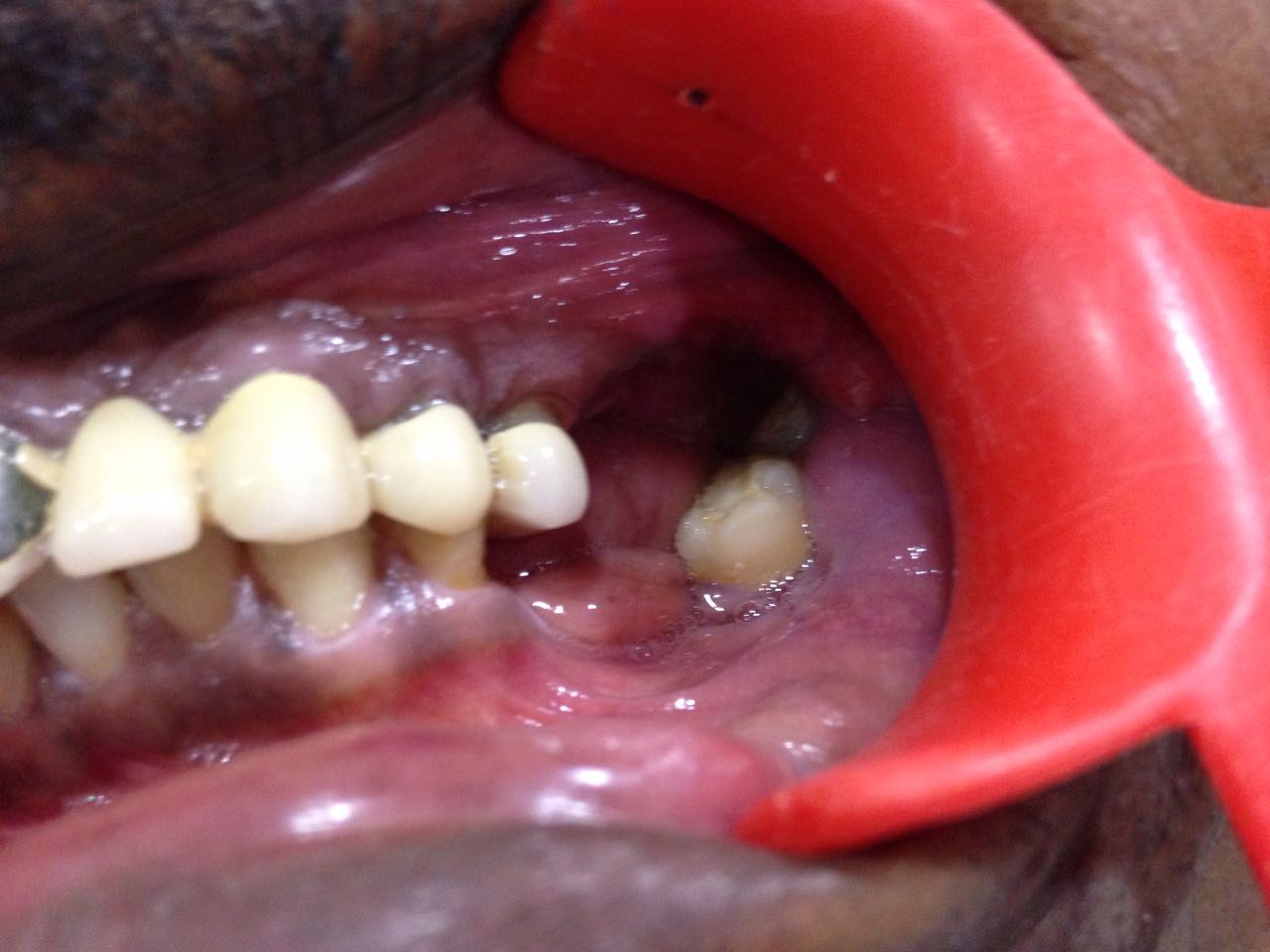 Case Studies, Jothi Dental & Cosmetology Centre, Chennai