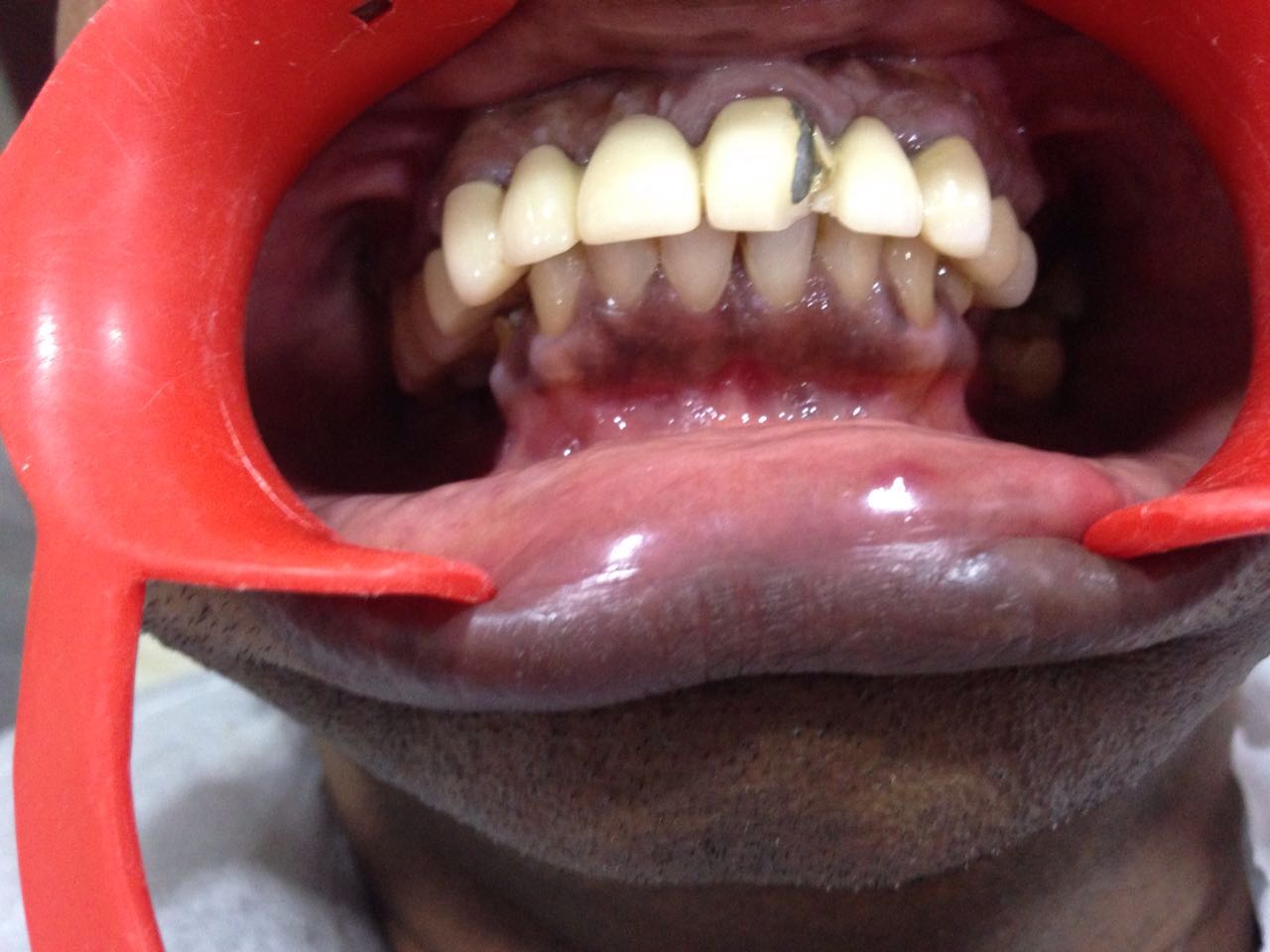 Case Studies, Jothi Dental & Cosmetology Centre, Chennai
