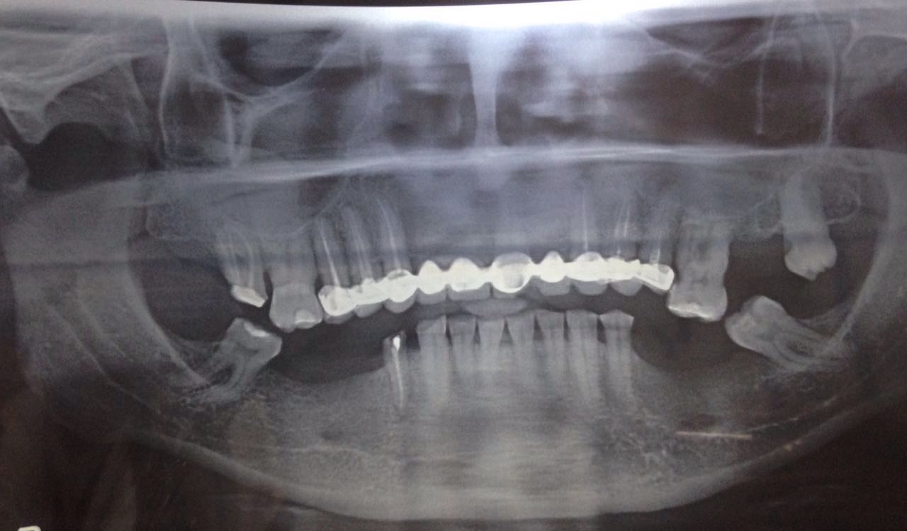Case Studies, Jothi Dental & Cosmetology Centre, Chennai