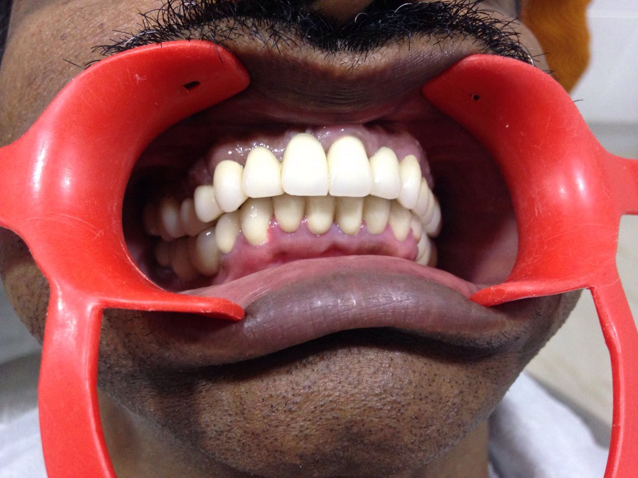 Case Studies, Jothi Dental & Cosmetology Centre, Chennai