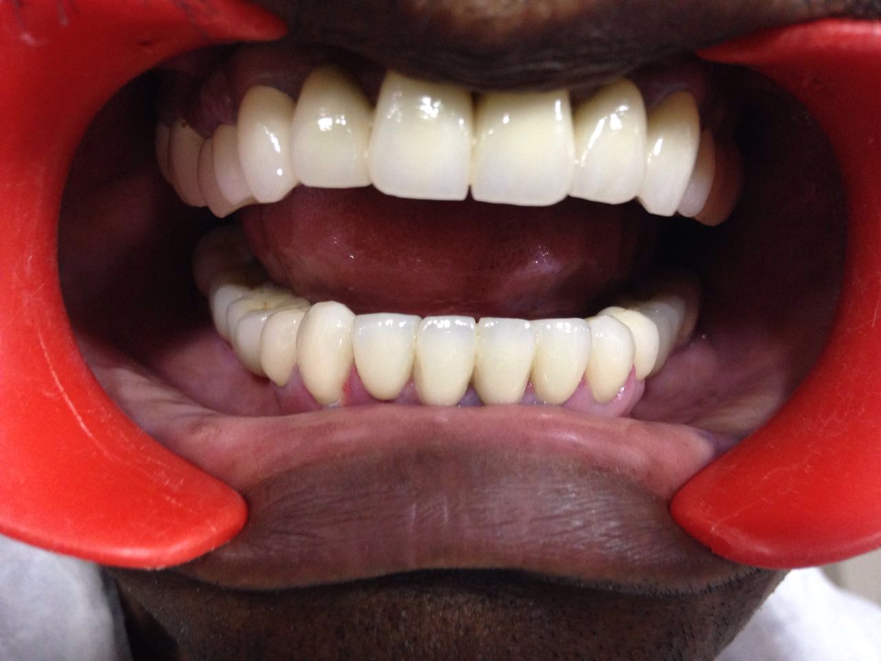 Case Studies, Jothi Dental & Cosmetology Centre, Chennai