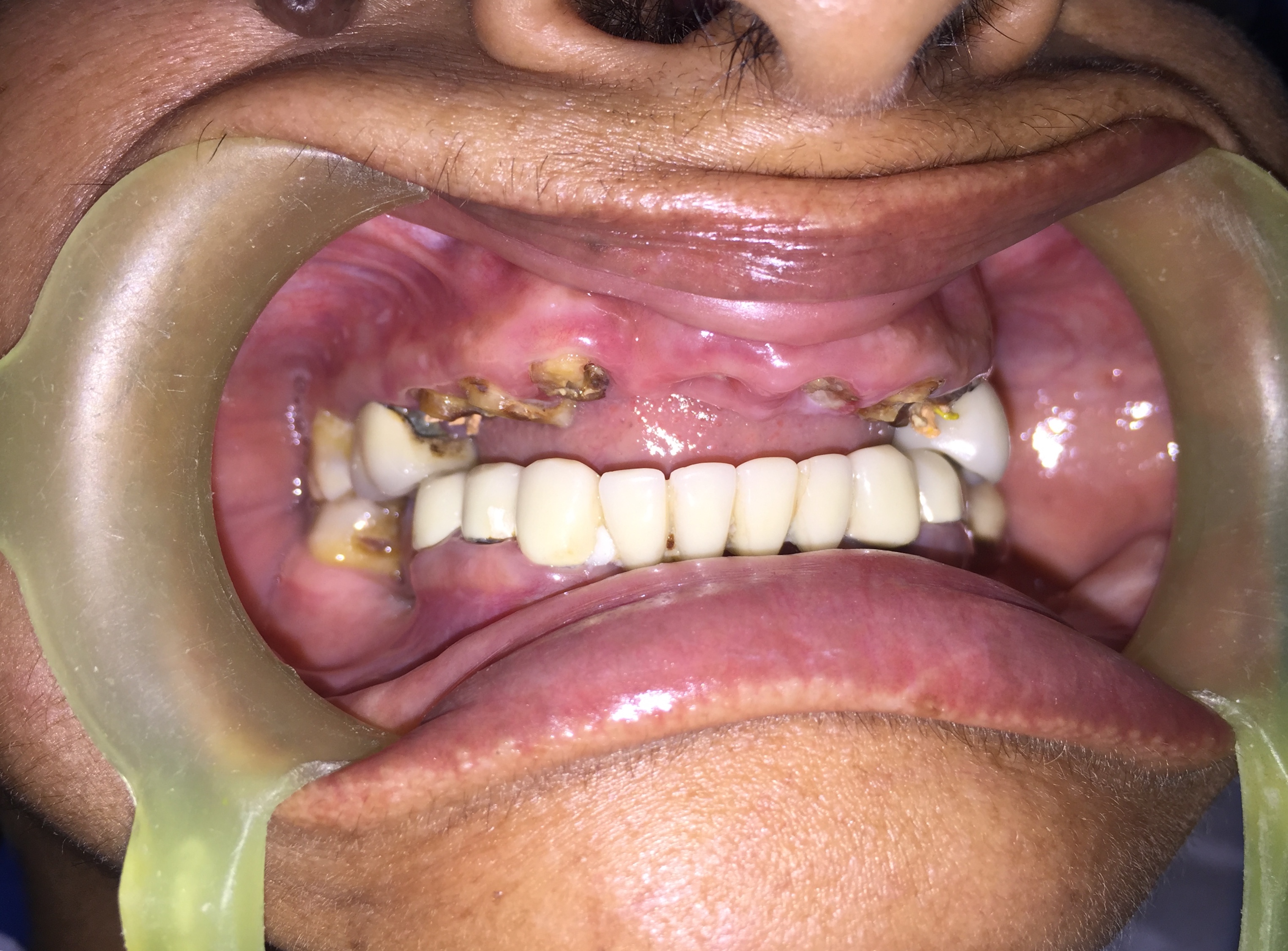 Case Studies, Jothi Dental & Cosmetology Centre, Chennai