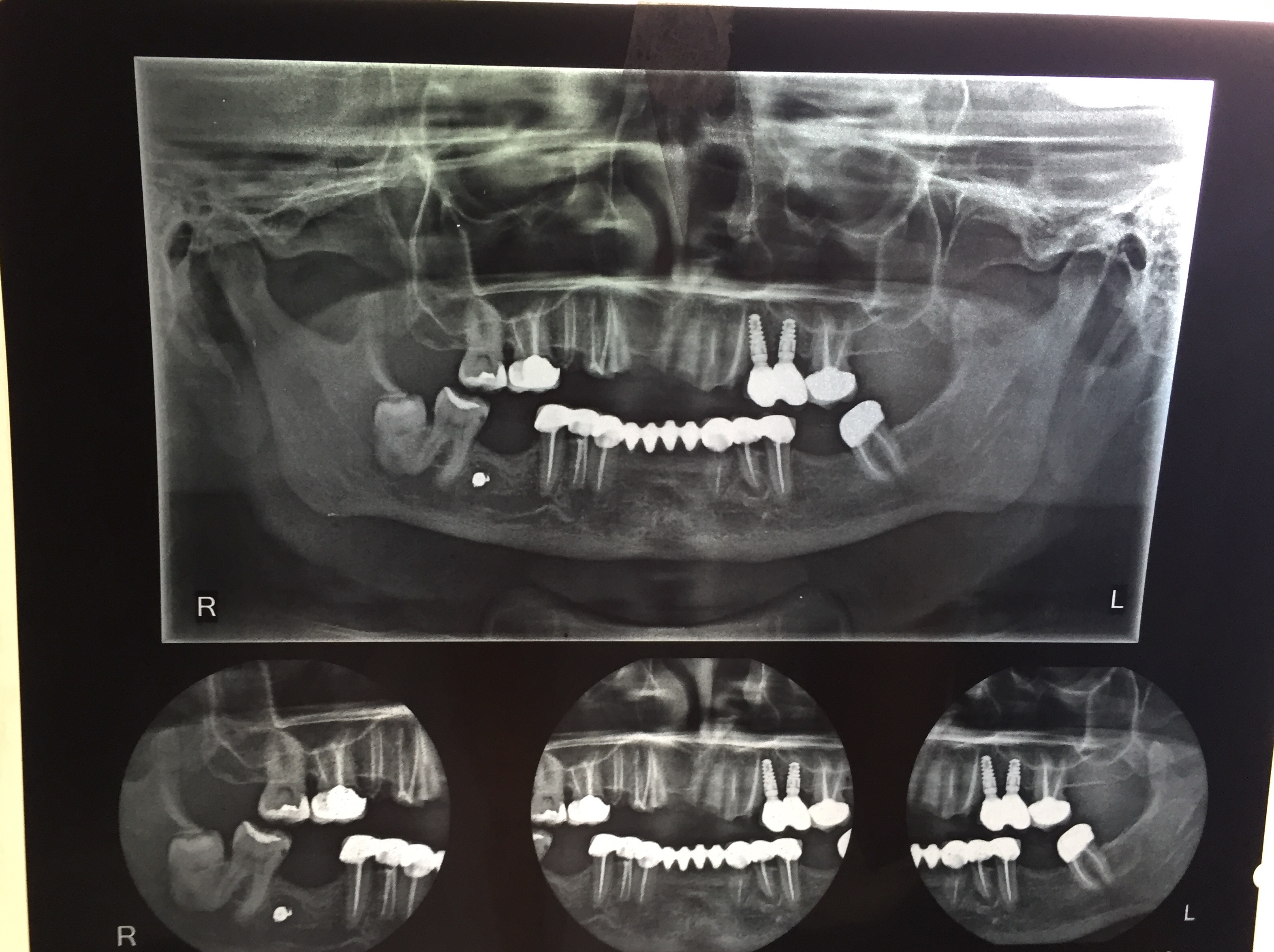 Case Studies, Jothi Dental & Cosmetology Centre, Chennai