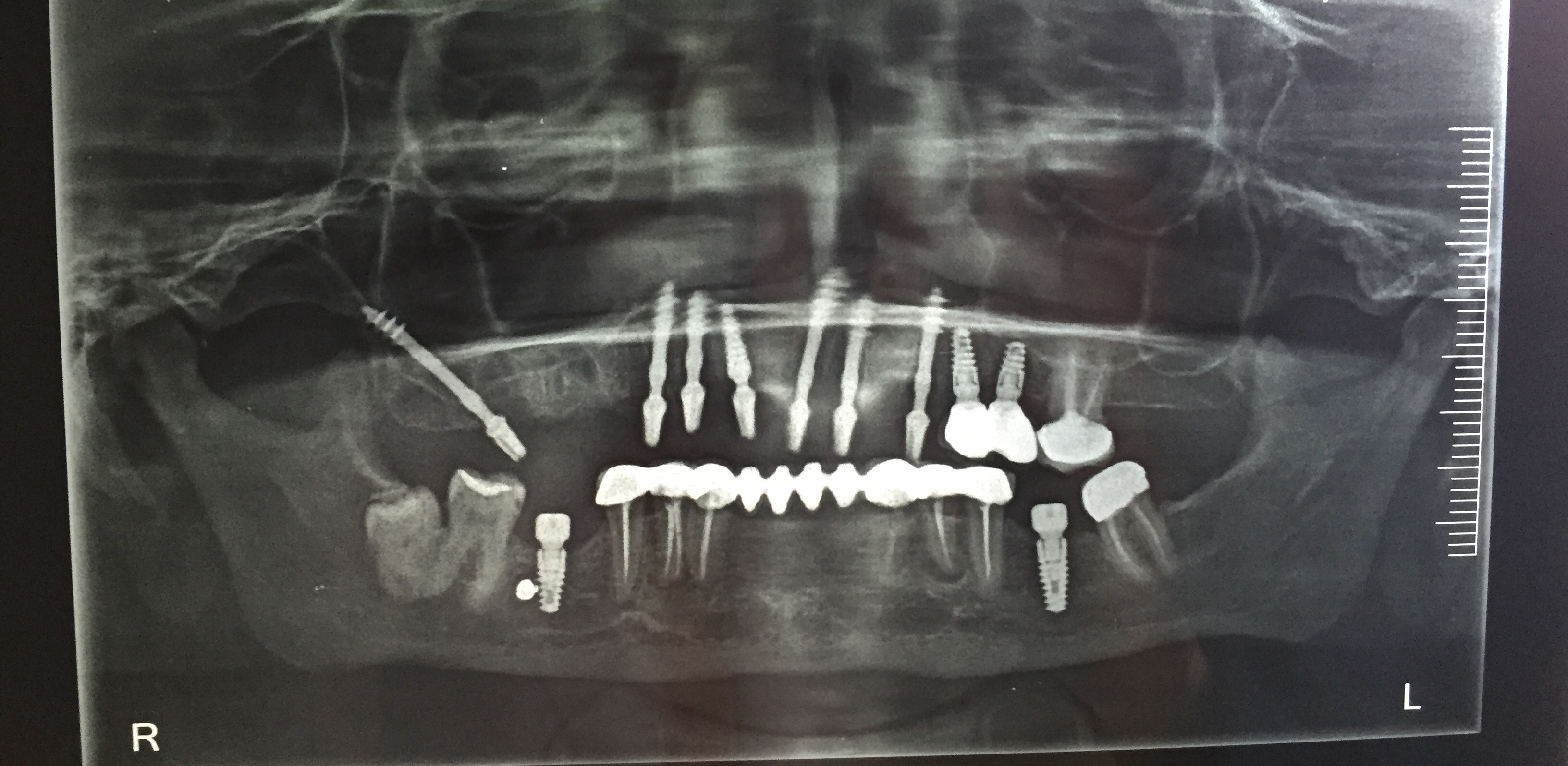 Case Studies, Jothi Dental & Cosmetology Centre, Chennai