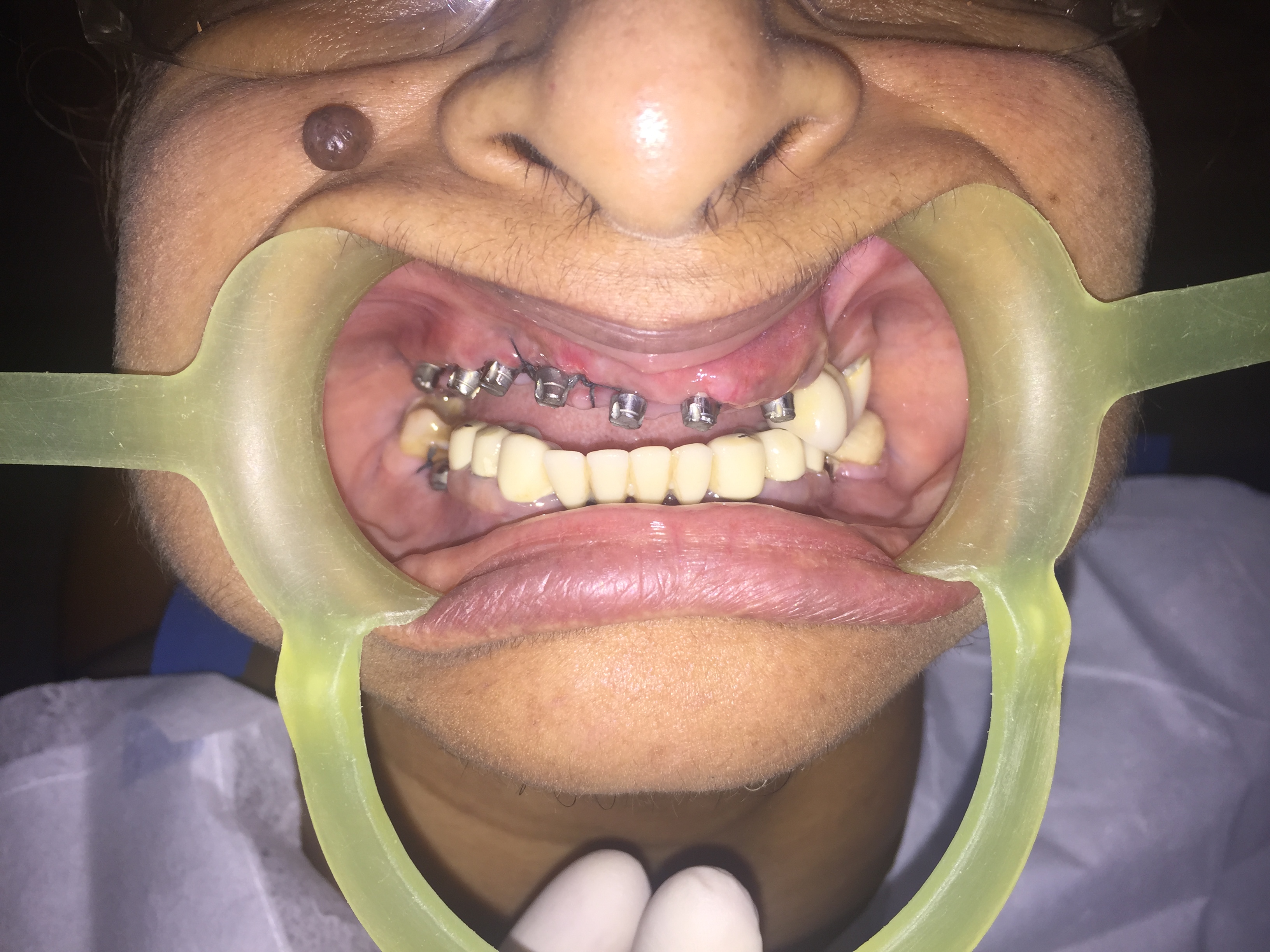 Case Studies, Jothi Dental & Cosmetology Centre, Chennai
