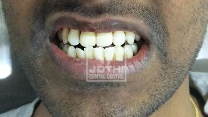Case Studies, Jothi Dental & Cosmetology Centre, Chennai