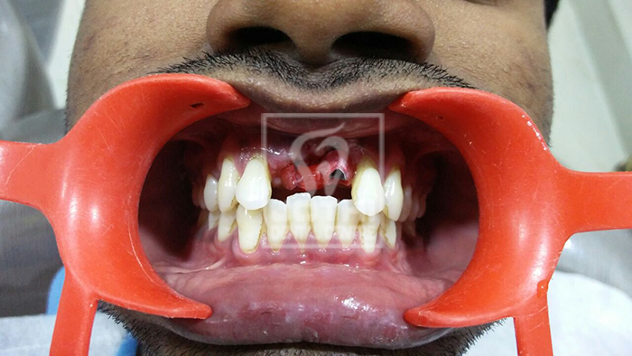 Case Studies, Jothi Dental & Cosmetology Centre, Chennai