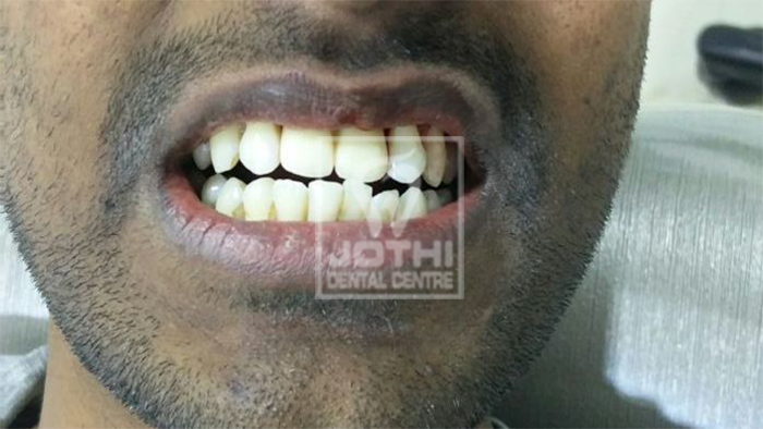 Case Studies, Jothi Dental & Cosmetology Centre, Chennai