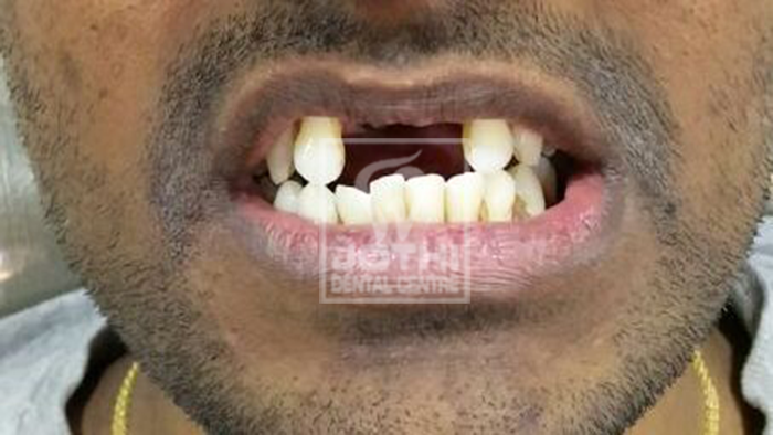 Case Studies, Jothi Dental & Cosmetology Centre, Chennai