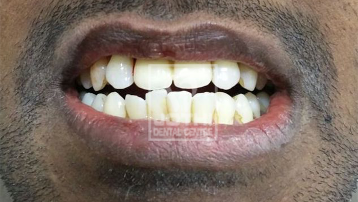 Case Studies, Jothi Dental & Cosmetology Centre, Chennai